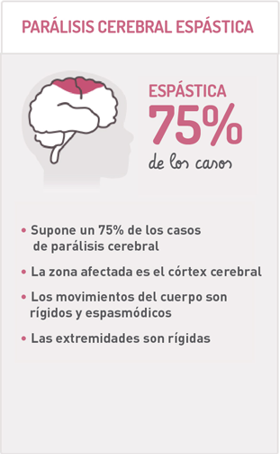 Tipos de parálisis cerebral infantil