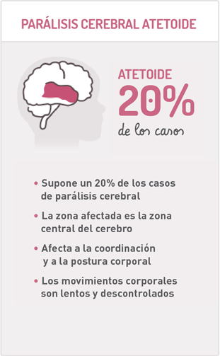 Tipos de parálisis cerebral infantil