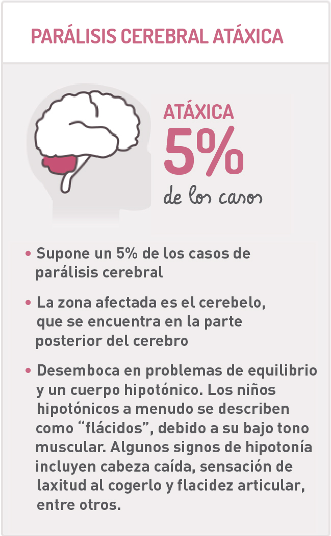 Tipos de parálisis cerebral infantil